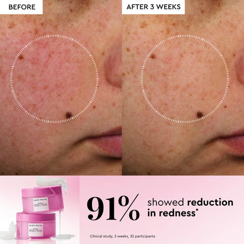 PDRN+ Repair + Soothe Korean Toner Pads